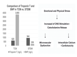 Takotsubo Cardiomyopathy: A Clinical Case of Stress-Induced Cardiomyopathy Without Precipitating Factors