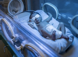 Recurrent Neonatal Hyperbilirubinemia Revealing Combined Crigler-Najjar and Gilbert Syndromes: A Case Report