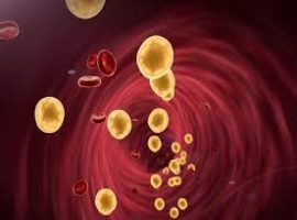 Aggregation Function of Basic Formed Blood Elements in Patients with Arterial Hypertension with Dyslipidemia Refused of Hypolipidemic Treatment