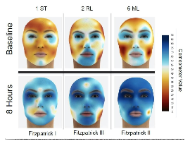 Facial Mask Moisturization Study: Case Report