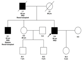 Identification of a PKD1 Non-truncating Variant Presenting with a Rapid Progression: A Case Report