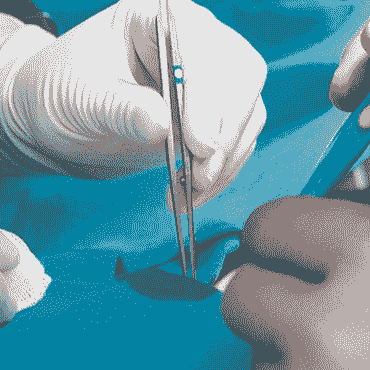 Surgery Case Reports Journal