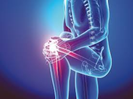Journal of Orthopaedics and Traumatology Case Reports